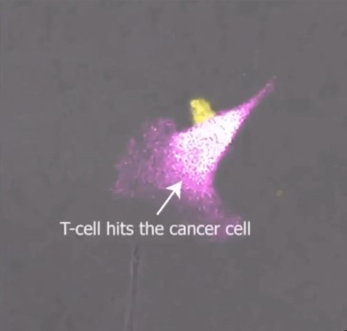 T-cell fights a Cancer cell